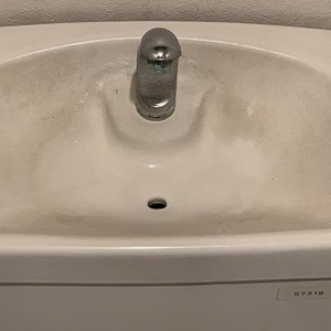 トイレの手洗いボウルの汚れ